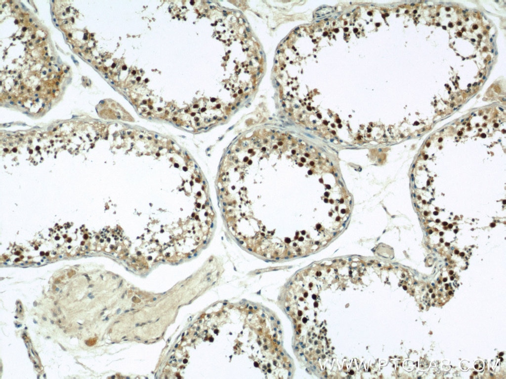 Immunohistochemistry (IHC) staining of human testis tissue using Coilin Polyclonal antibody (10967-1-AP)