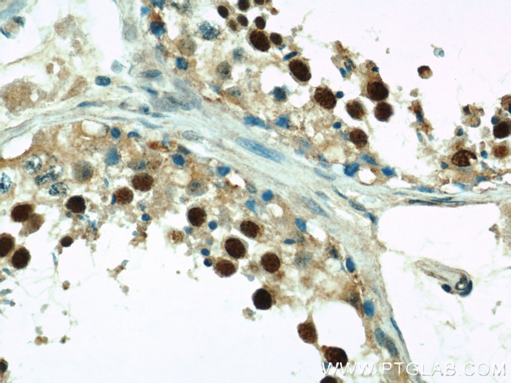 IHC staining of human testis using 10967-1-AP