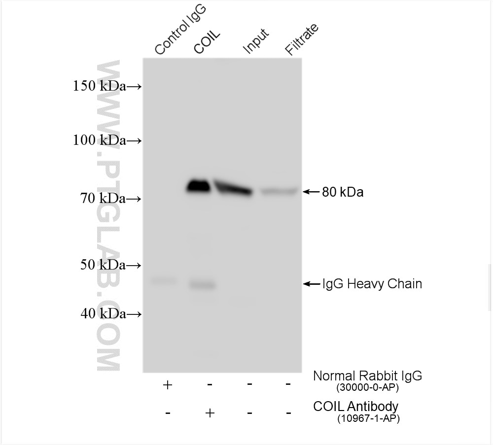 Immunoprecipitation (IP) experiment of HEK-293 cells using Coilin Polyclonal antibody (10967-1-AP)