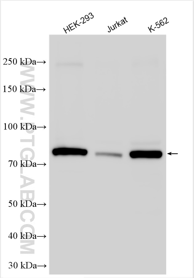 Western Blot (WB) analysis of various lysates using Coilin Polyclonal antibody (10967-1-AP)