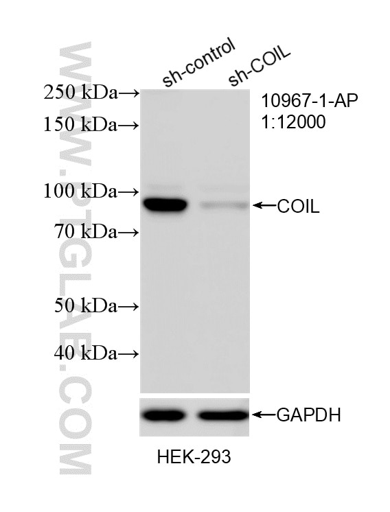 WB analysis of HEK-293 using 10967-1-AP Western Blot (WB) analysis of HEK-293 cells using Coilin Polyclonal antibody (10967-1-AP)