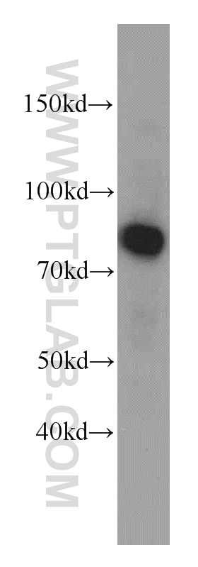 Western Blot (WB) analysis of human brain tissue using Coilin Polyclonal antibody (10967-1-AP)