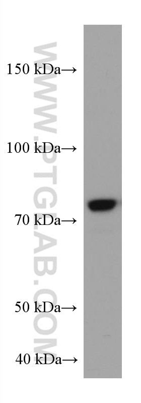 Western Blot (WB) analysis of HeLa cells using COIL Monoclonal antibody (67218-1-Ig)