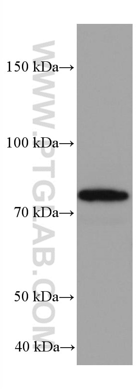 Western Blot (WB) analysis of HEK-293 cells using COIL Monoclonal antibody (67218-1-Ig)