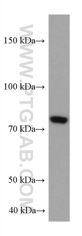 Western Blot (WB) analysis of HepG2 cells using COIL Monoclonal antibody (67218-1-Ig)