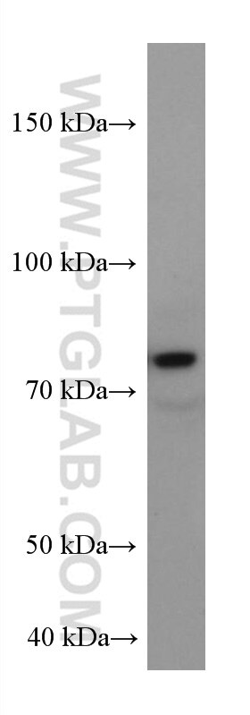 Western Blot (WB) analysis of Jurkat cells using COIL Monoclonal antibody (67218-1-Ig)