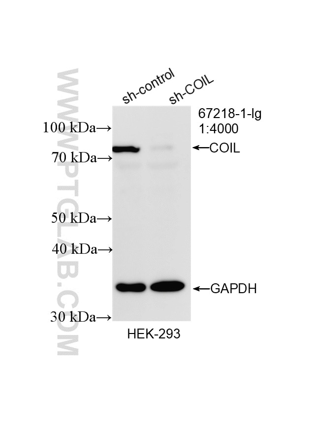 Western Blot (WB) analysis of HEK-293 cells using Coilin Monoclonal antibody (67218-1-Ig)