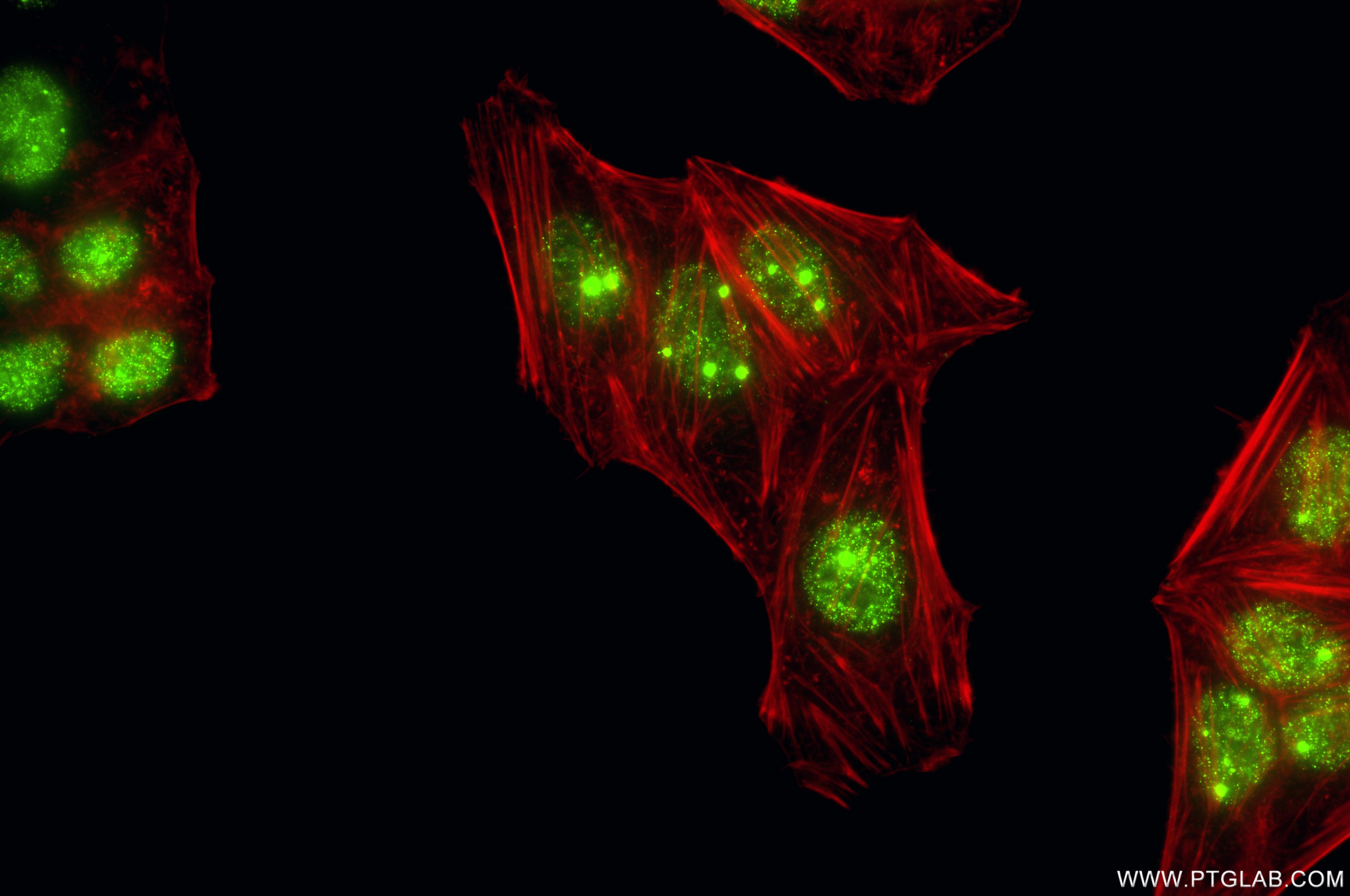 IF Staining of HepG2 using 87171-1-RR Immunofluorescence (IF) / fluorescent staining of HepG2 cells using COIL Recombinant monoclonal antibody (87171-1-RR)
