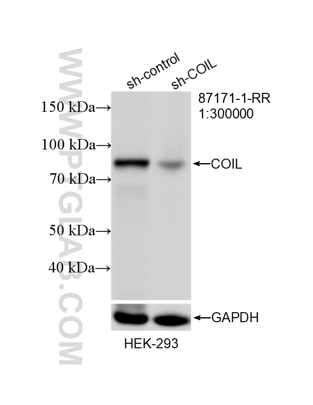 WB analysis of HEK-293 using 87171-1-RR Western Blot (WB) analysis of HEK-293 cells using Coilin Recombinant monoclonal antibody (87171-1-RR)