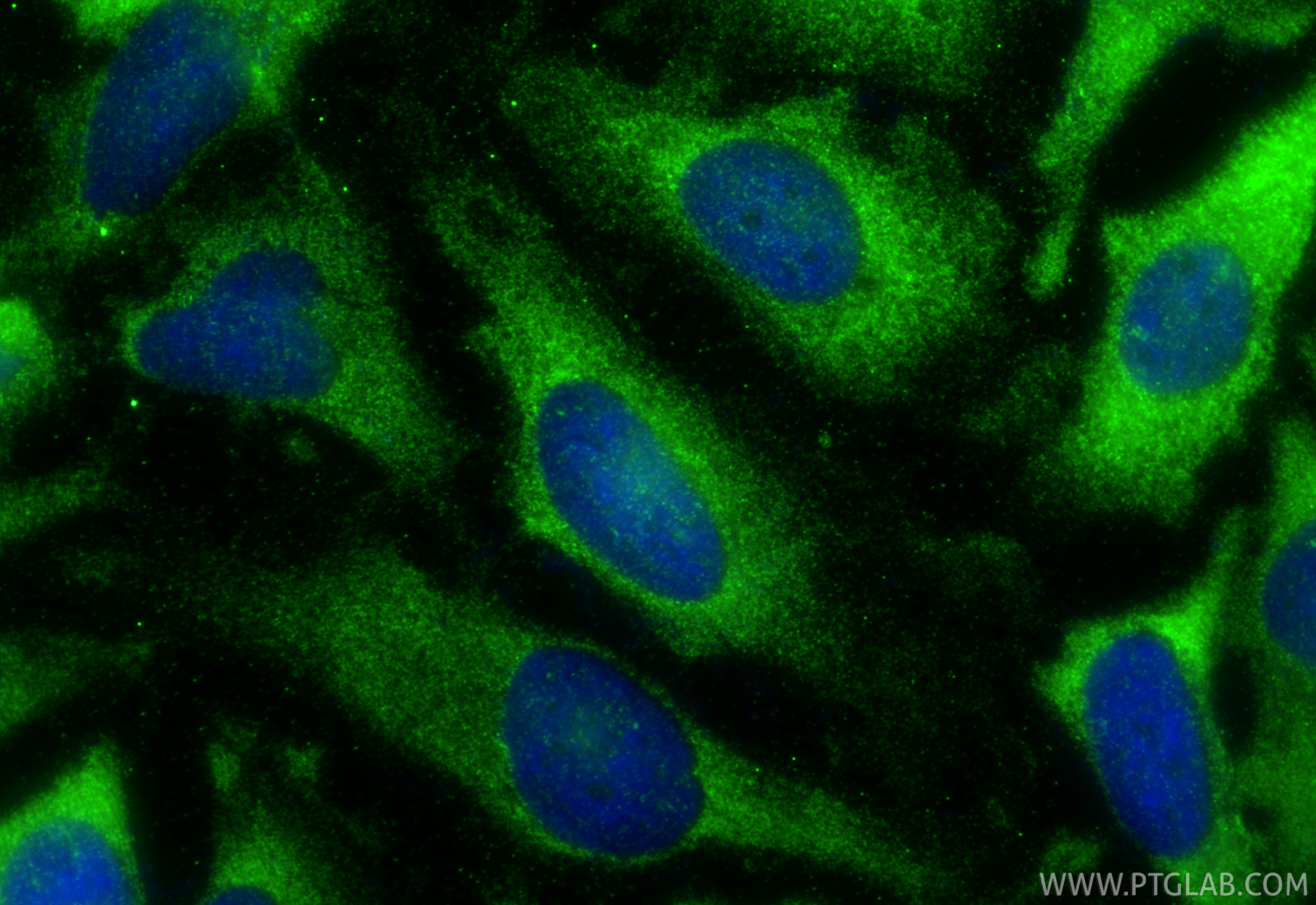 Immunofluorescent analysis of (-20°C Methanol) fixed HeLa cells using Collagen Type X antibody (26984-1-AP) at dilution of 1:400 and CoraLite®488-Conjugated Goat Anti-Rabbit IgG(H+L) (SA00013-2). Immunofluorescence (IF) / fluorescent staining of HeLa cells using Collagen Type X Polyclonal antibody (26984-1-AP)