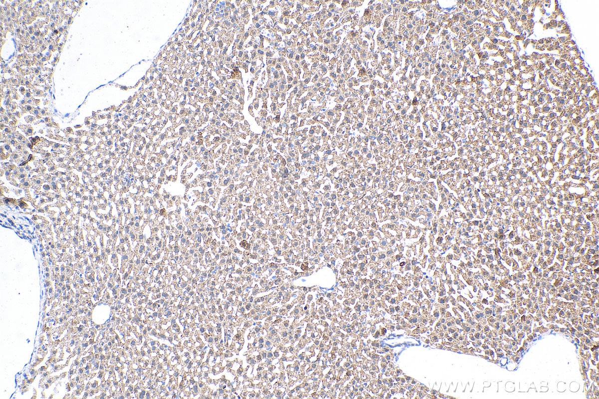 Immunohistochemistry (IHC) staining of mouse liver tissue using COL10A1 Polyclonal antibody (26984-1-AP)