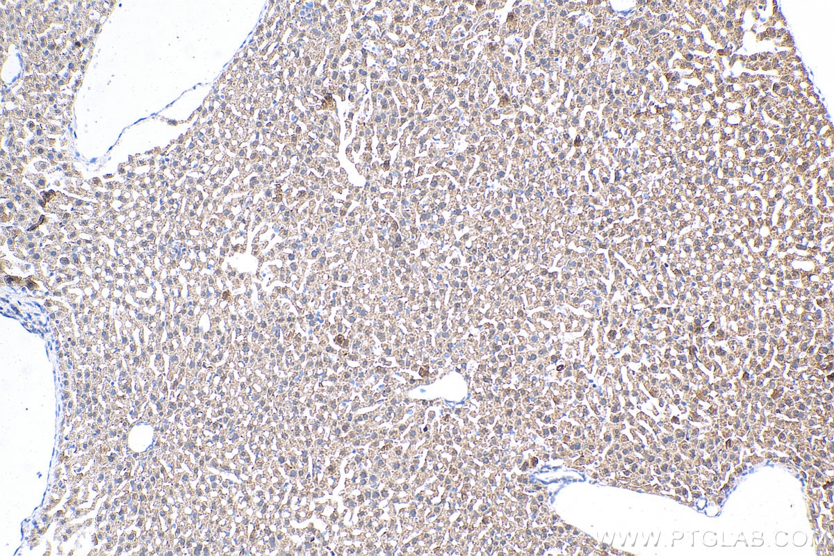 Immunohistochemistry (IHC) staining of mouse liver tissue using Collagen Type X Polyclonal antibody (26984-1-AP)