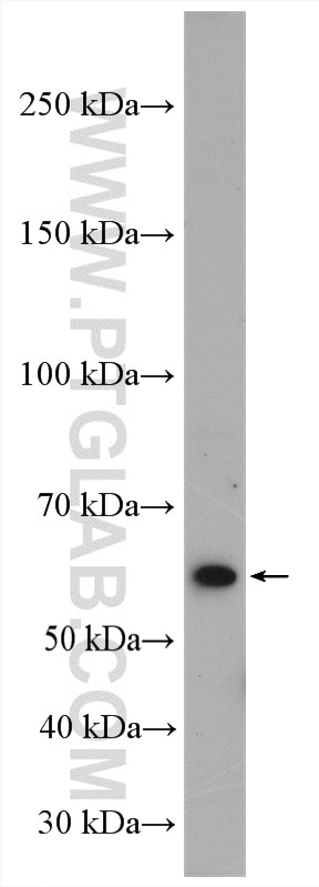Western Blot (WB) analysis of ROS1728 cells using Collagen Type X Polyclonal antibody (26984-1-AP)