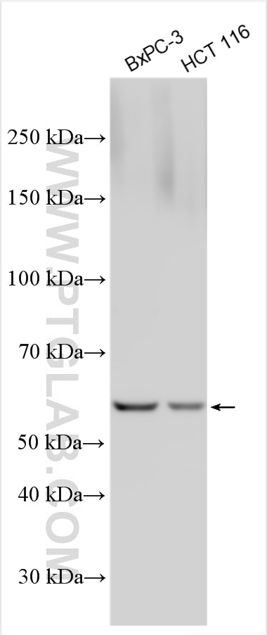 Western Blot (WB) analysis of various lysates using Collagen Type X Polyclonal antibody (26984-1-AP)