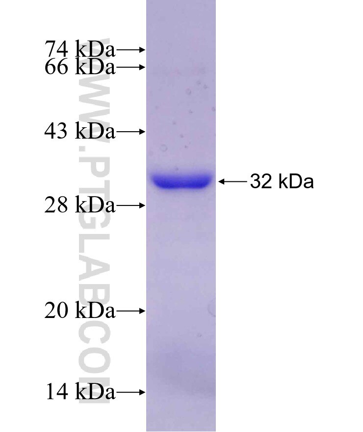COL10A1 fusion protein Ag29739 SDS-PAGE