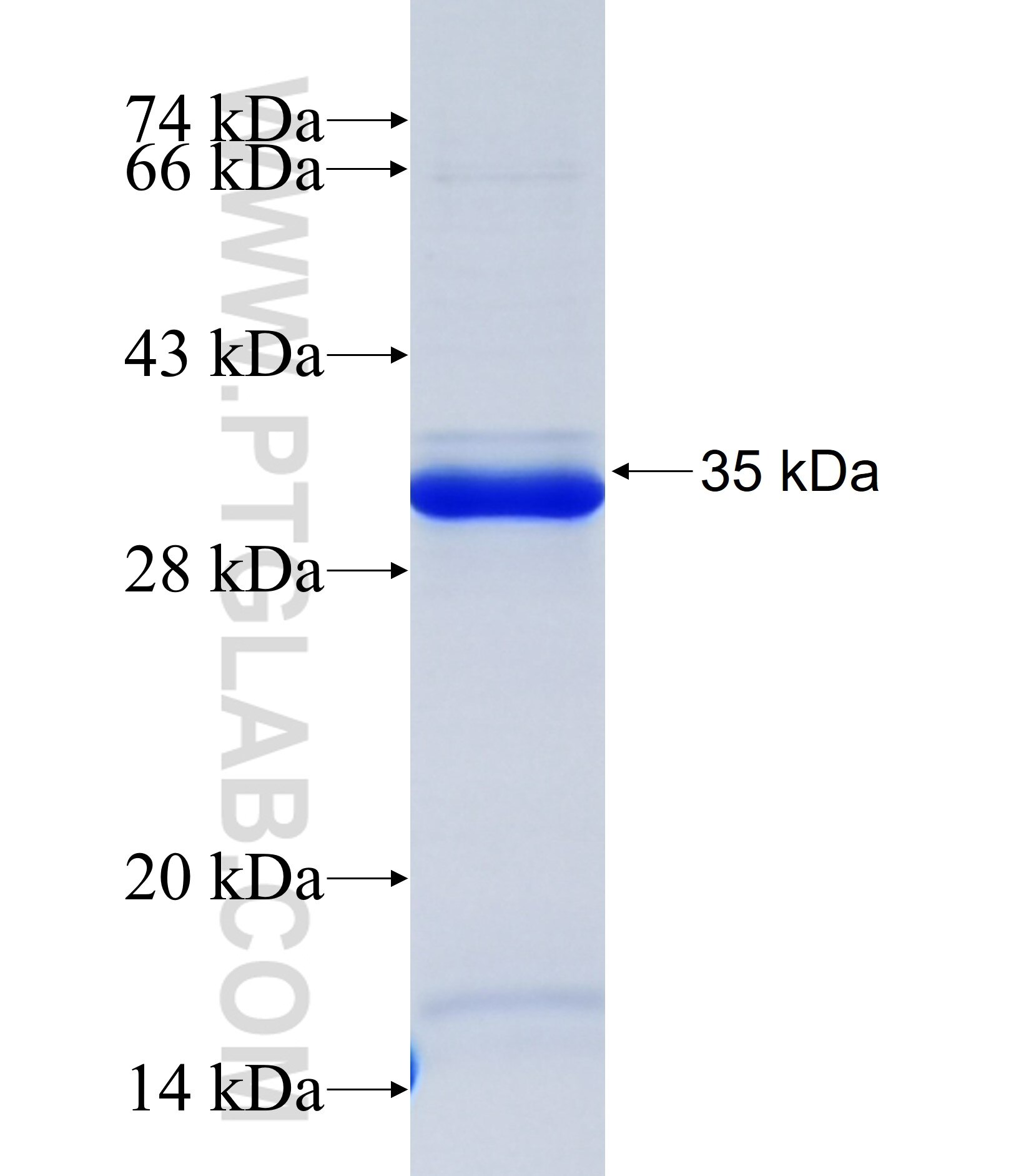 COL11A1 fusion protein Ag38139 SDS-PAGE