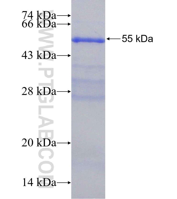 COL11A1 fusion protein Ag16509 SDS-PAGE