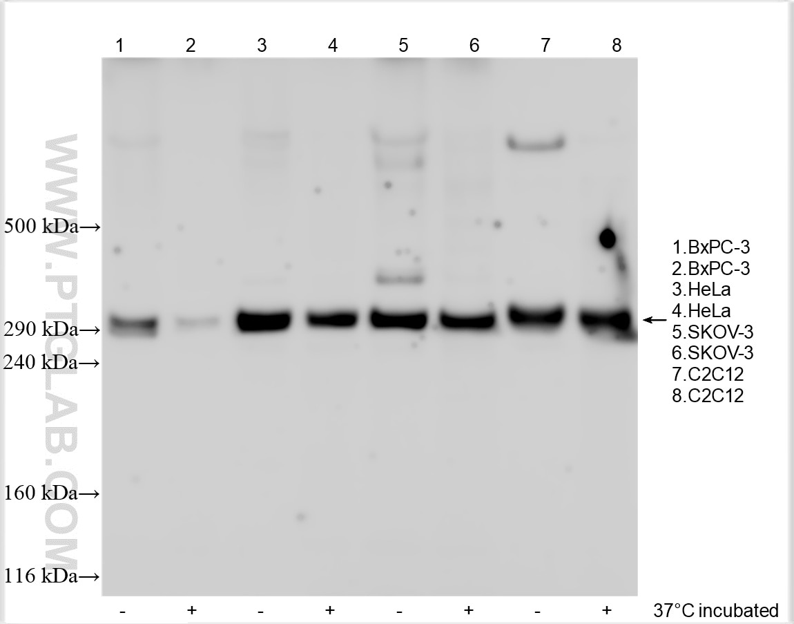 Collagen Type XII