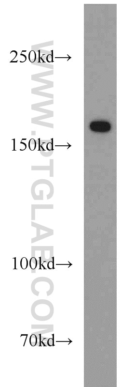 Western Blot (WB) analysis of human placenta tissue using Collagen Type XVI Polyclonal antibody (19802-1-AP)