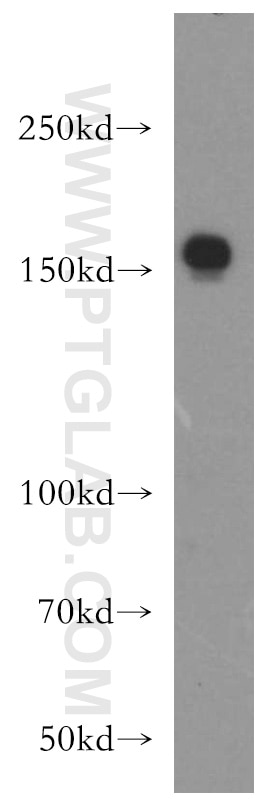 Western Blot (WB) analysis of human placenta tissue using Collagen Type XVI Polyclonal antibody (19802-1-AP)