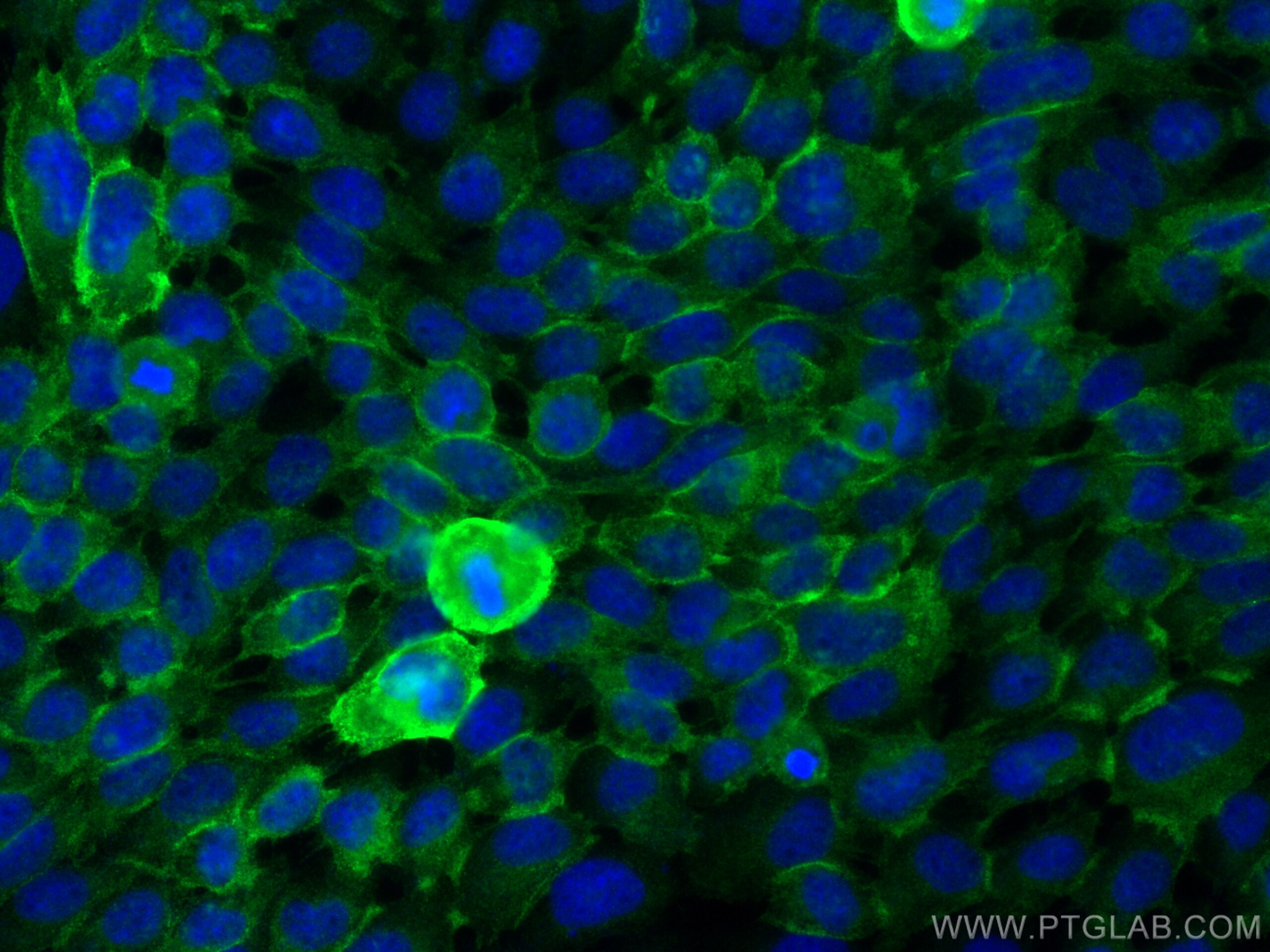 Immunofluorescence (IF) / fluorescent staining of A431 cells using Collagen Type XVII Polyclonal antibody (31190-1-AP)