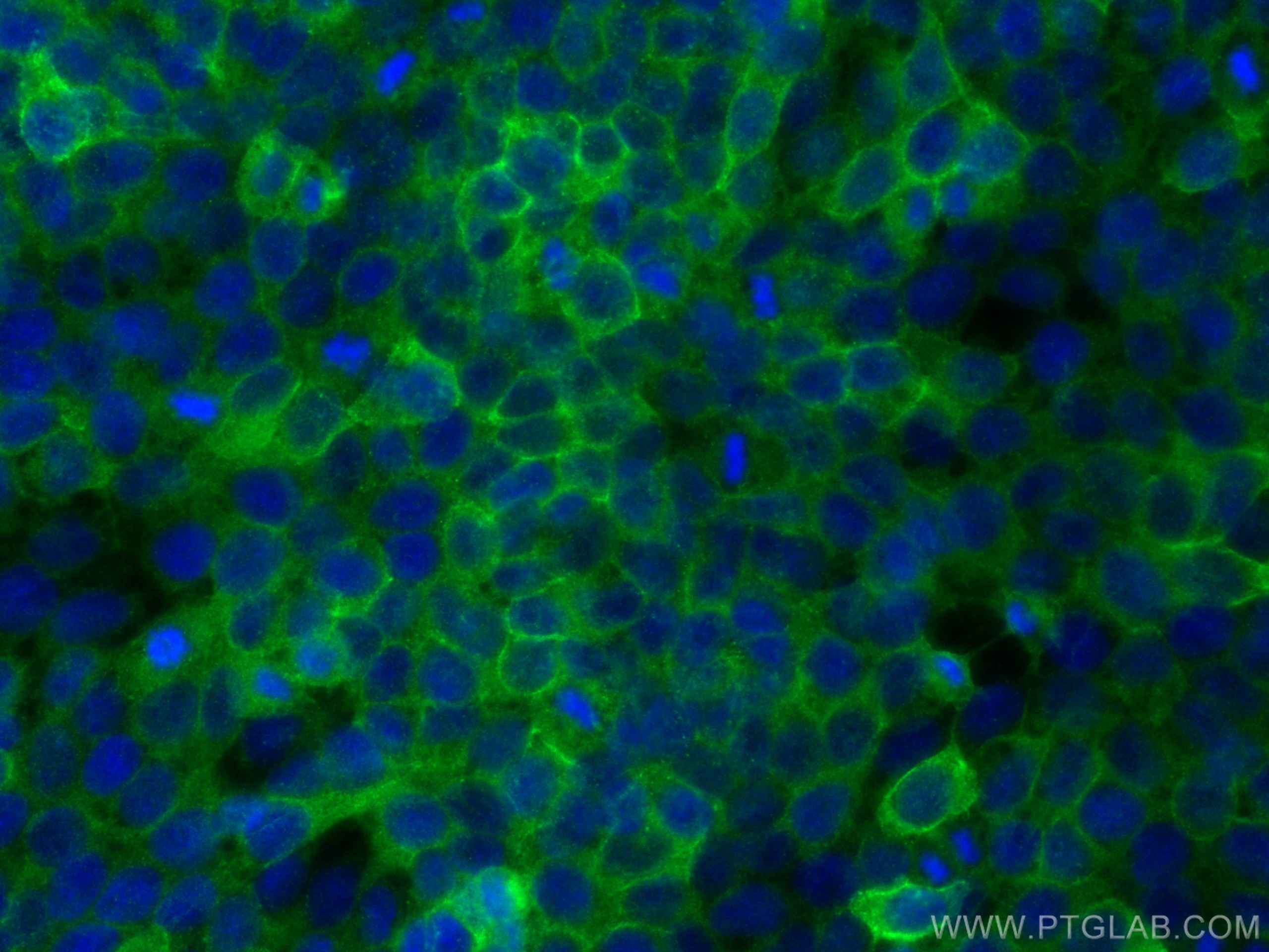Immunofluorescence (IF) / fluorescent staining of HaCaT cells using Collagen Type XVII Polyclonal antibody (31190-1-AP)