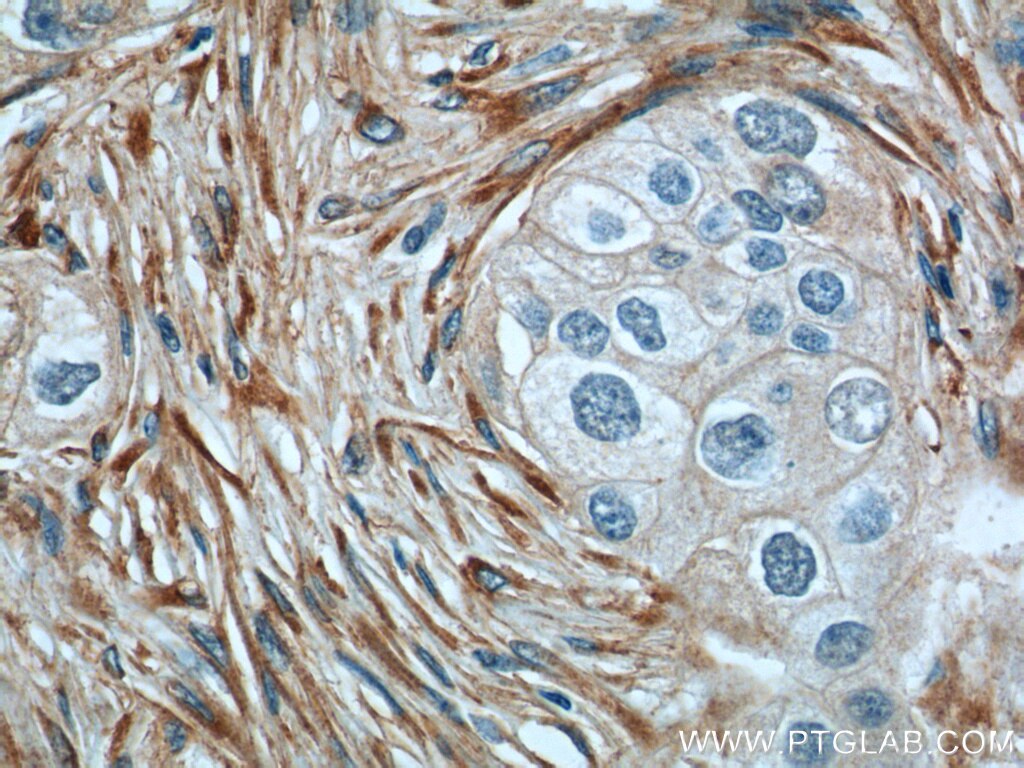 Collagen Type I Polyclonal antibody