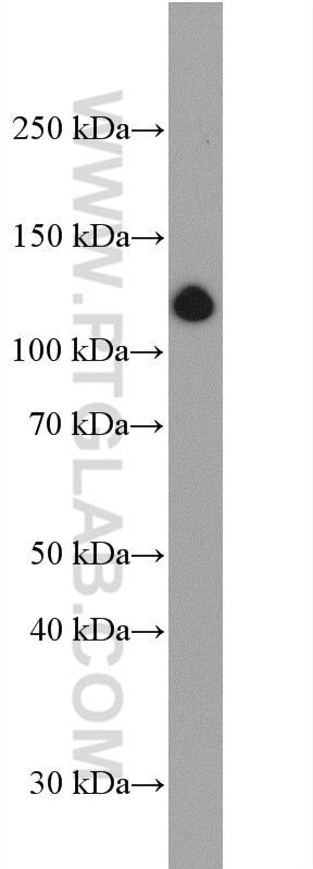 Western Blot (WB) analysis of pig skin tissue using Collagen Type I Polyclonal antibody (14695-1-AP)