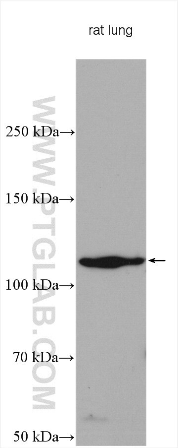 Western Blot (WB) analysis of various lysates using Collagen Type I Polyclonal antibody (14695-1-AP)