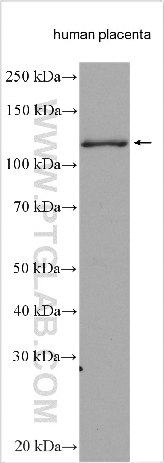 WB analysis using 14695-1-AP