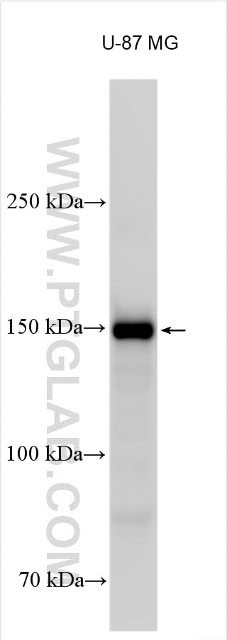 Western Blot (WB) analysis of various lysates using Collagen Type I Polyclonal antibody (14695-1-AP)