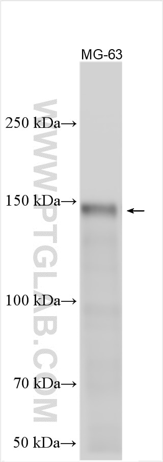 Western Blot (WB) analysis of various lysates using Collagen Type I Polyclonal antibody (14695-1-AP)