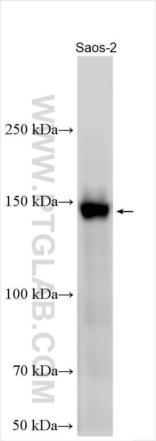 Western Blot (WB) analysis of various lysates using Collagen Type I Polyclonal antibody (14695-1-AP)