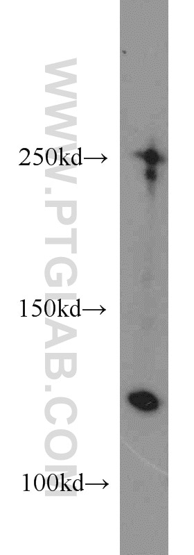 Collagen Type I Polyclonal antibody