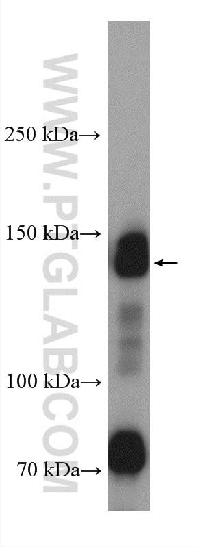 Western Blot (WB) analysis of pig skin tissue using Collagen Type I Monoclonal antibody (66761-1-Ig)