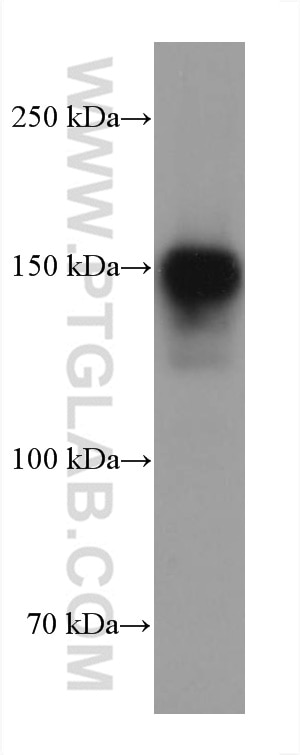 Western Blot (WB) analysis of rat skin tissue using Collagen Type I Monoclonal antibody (66761-1-Ig)