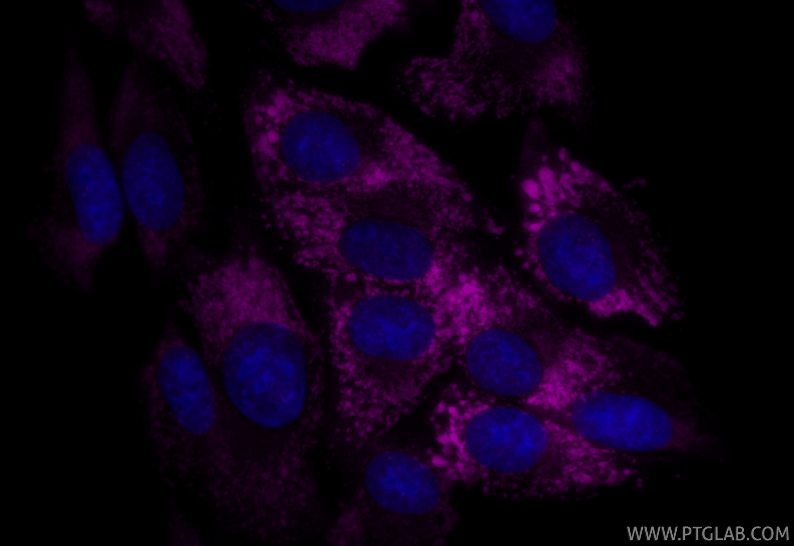 IF Staining of HSC-T6 using CL647-83752-5 Immunofluorescence (IF) / fluorescent staining of HSC-T6 cells using CoraLite® Plus 647-conjugated Collagen Type I Reco (CL647-83752-5)