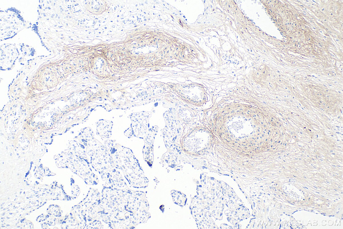 Immunohistochemical analysis of paraffin-embedded human placenta tissue slide using 83752-5-RR (Collagen Type I antibody) at dilution of 1:1000 (under 10x lens). Heat mediated antigen retrieval with Tris-EDTA buffer (pH 9.0). Immunohistochemistry (IHC) staining of human placenta tissue using Collagen Type I Recombinant monoclonal antibody (83752-5-RR)