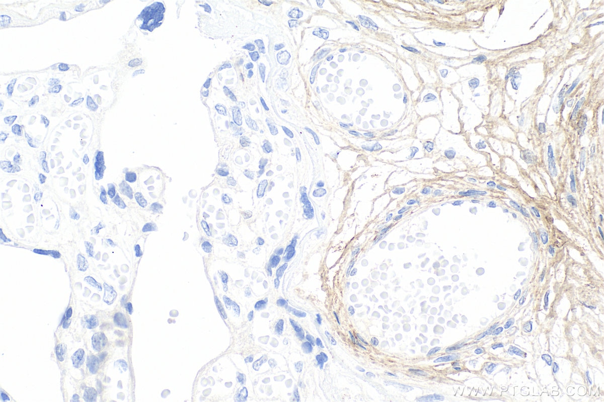 Immunohistochemical analysis of paraffin-embedded human placenta tissue slide using 83752-5-RR (Collagen Type I antibody) at dilution of 1:1000 (under 40x lens). Heat mediated antigen retrieval with Tris-EDTA buffer (pH 9.0). Immunohistochemistry (IHC) staining of human placenta tissue using Collagen Type I Recombinant monoclonal antibody (83752-5-RR)
