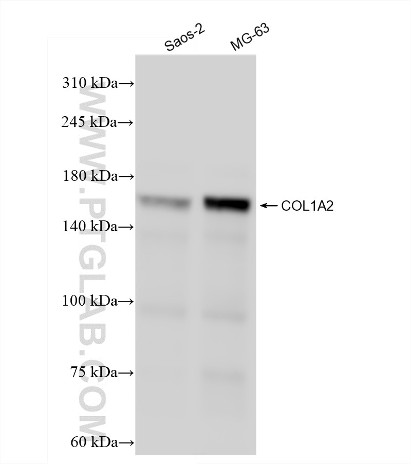 Western Blot (WB) analysis of Saos-2 cells using Collagen Type I Recombinant antibody (83752-5-RR)