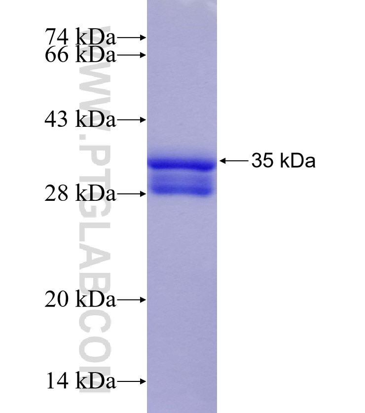 COL1A2 fusion protein Ag25575 SDS-PAGE