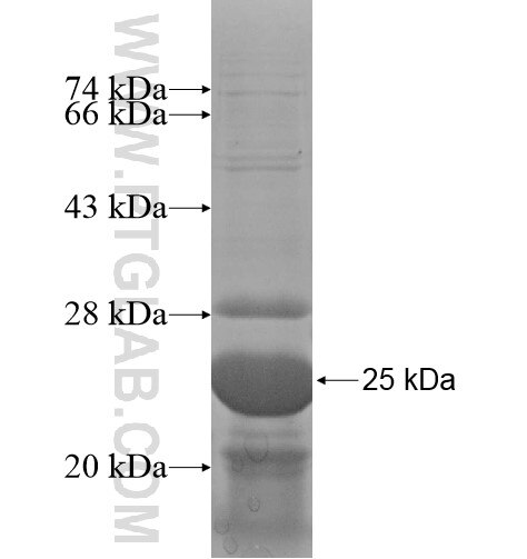 COL20A1 fusion protein Ag11418 SDS-PAGE