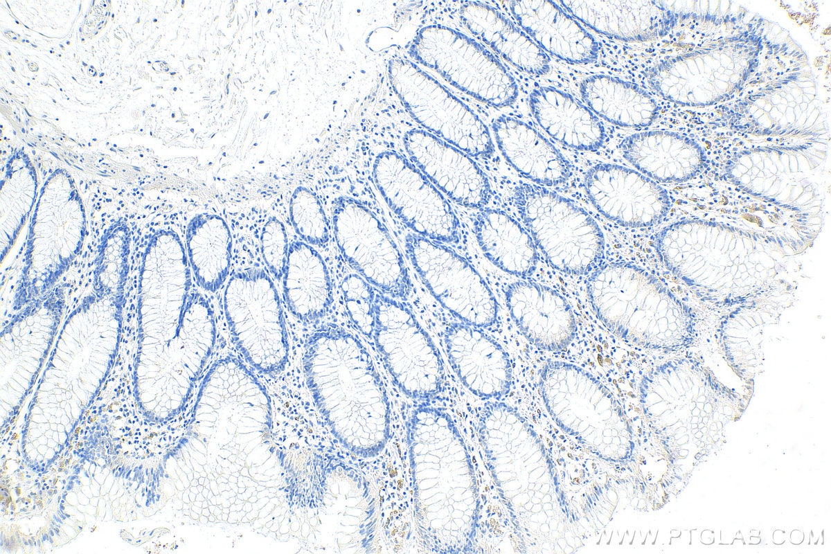 Immunohistochemistry (IHC) staining of human colon tissue using Collagen Type XXIII Polyclonal antibody (14337-1-AP)