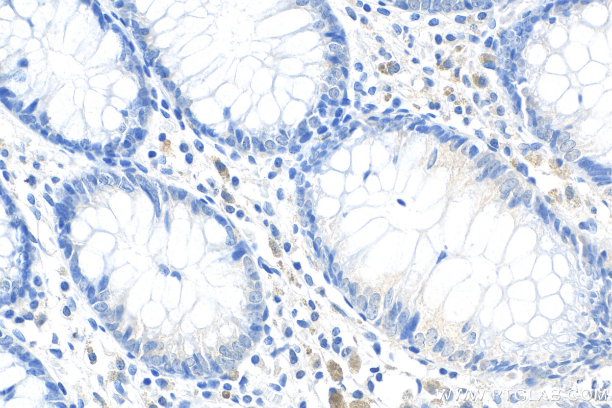 Immunohistochemistry (IHC) staining of human colon tissue using Collagen Type XXIII Polyclonal antibody (14337-1-AP)