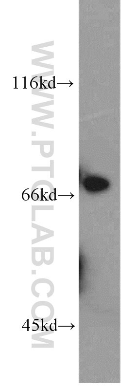 WB analysis of mouse thymus using 14337-1-AP