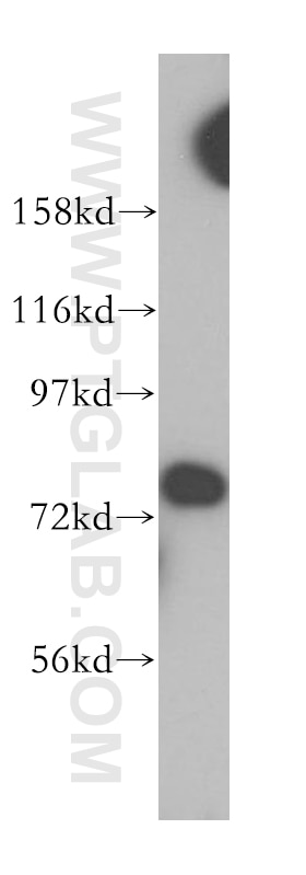 Western Blot (WB) analysis of mouse thymus tissue using Collagen Type XXIII Polyclonal antibody (14337-1-AP)