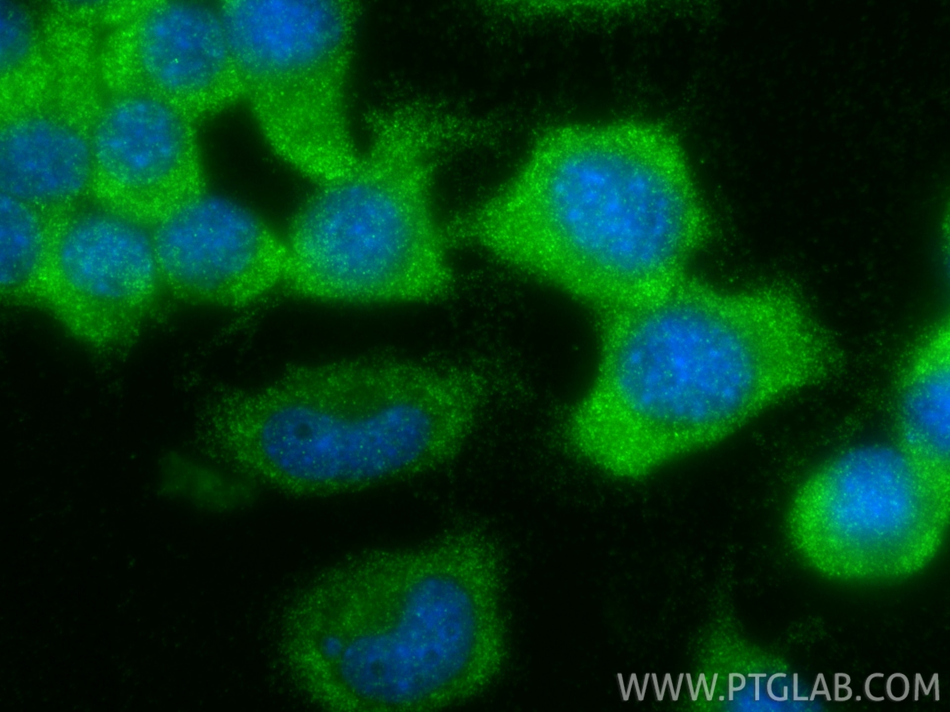 Immunofluorescence (IF) / fluorescent staining of Neuro-2a cells using Collagen Type XXV Polyclonal antibody (12738-1-AP)