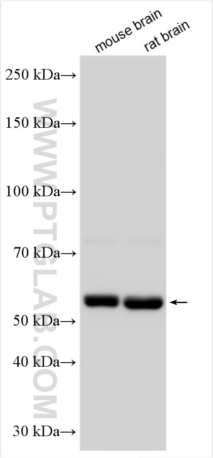 Western Blot (WB) analysis of various lysates using Collagen Type XXV Polyclonal antibody (12738-1-AP)