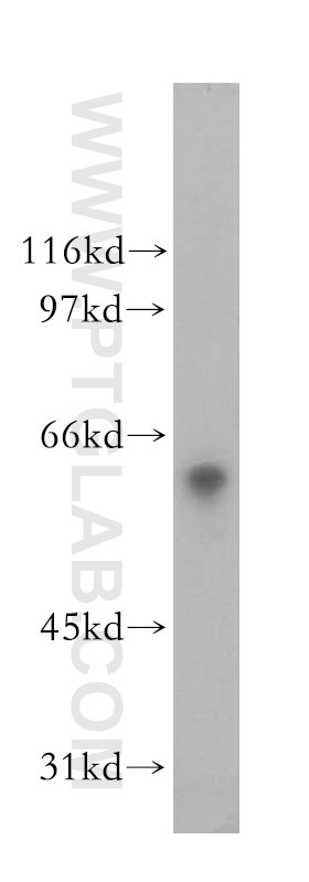 Collagen Type XXV