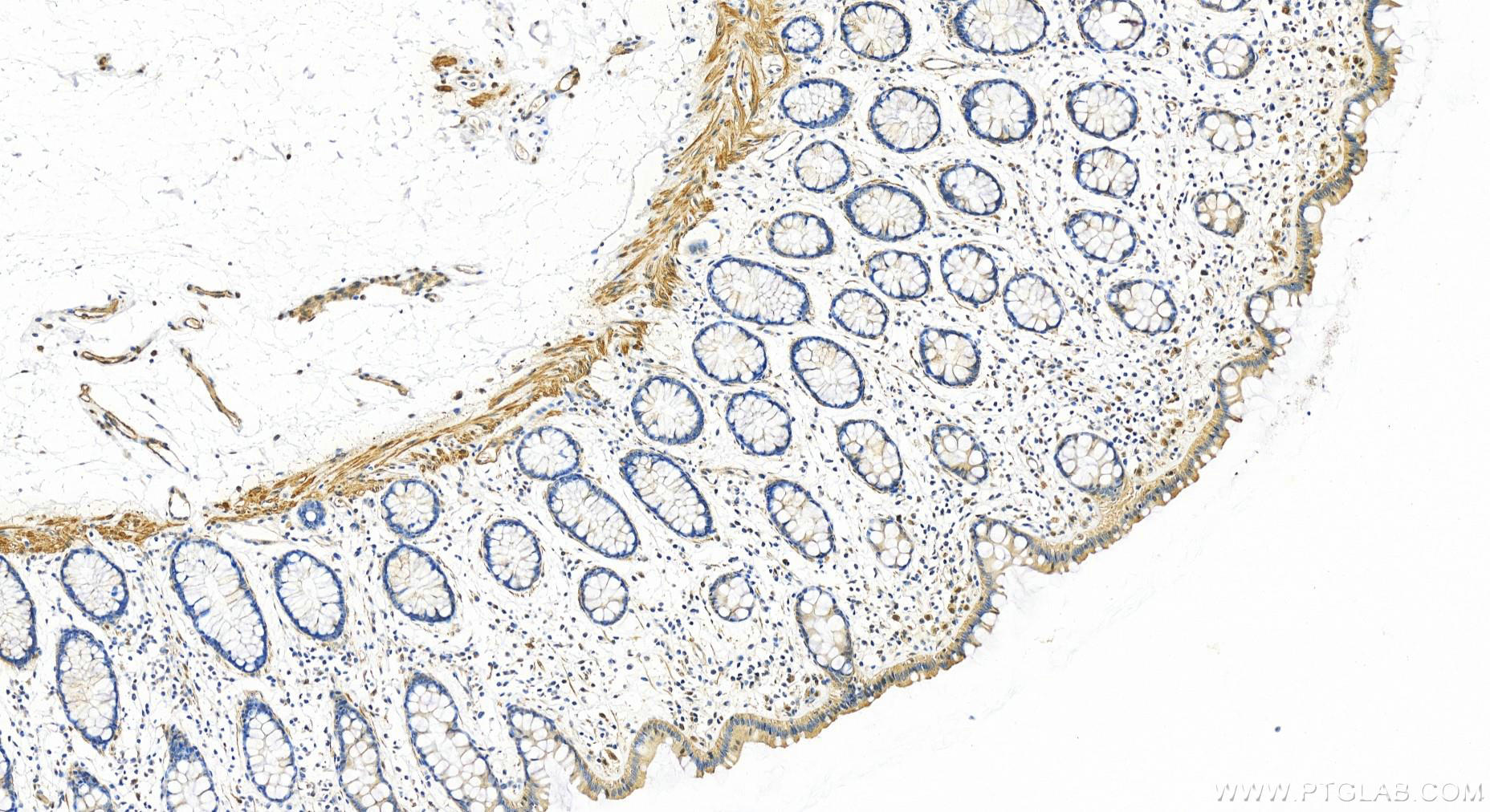 Immunohistochemistry (IHC) staining of human colon tissue using COL26A1 Polyclonal antibody (21106-1-AP)